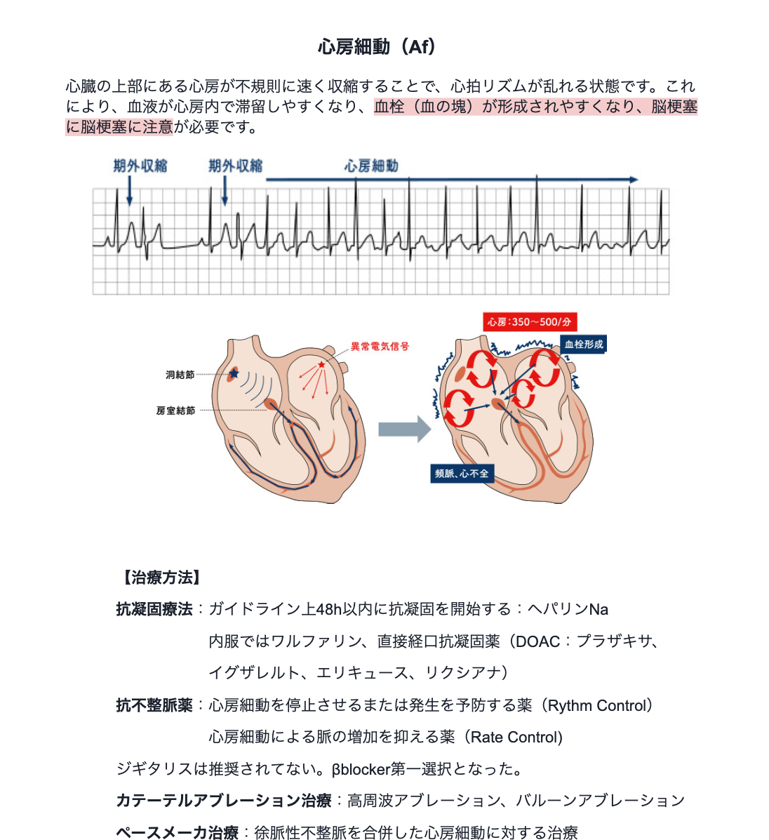 心電図マニュアル