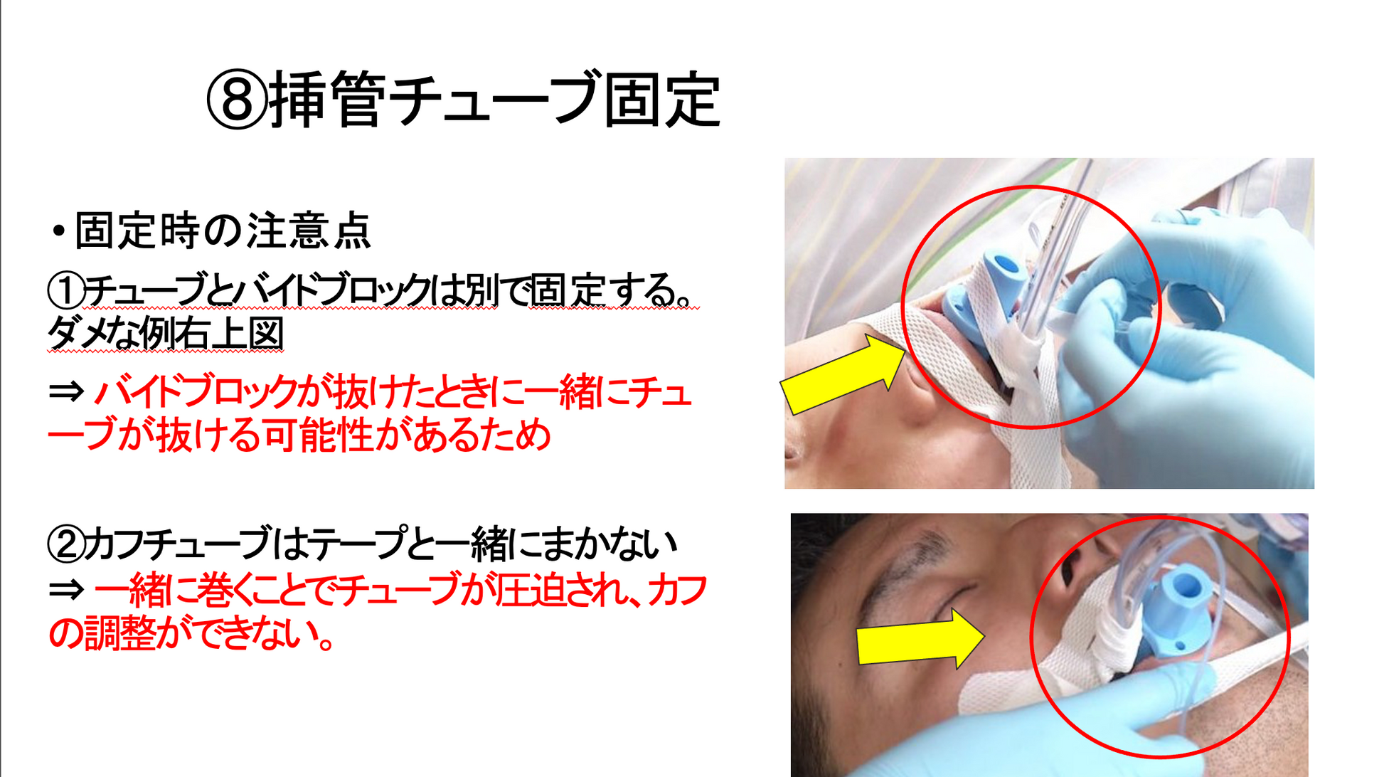 気管 挿管 テープ 固定 ショップ